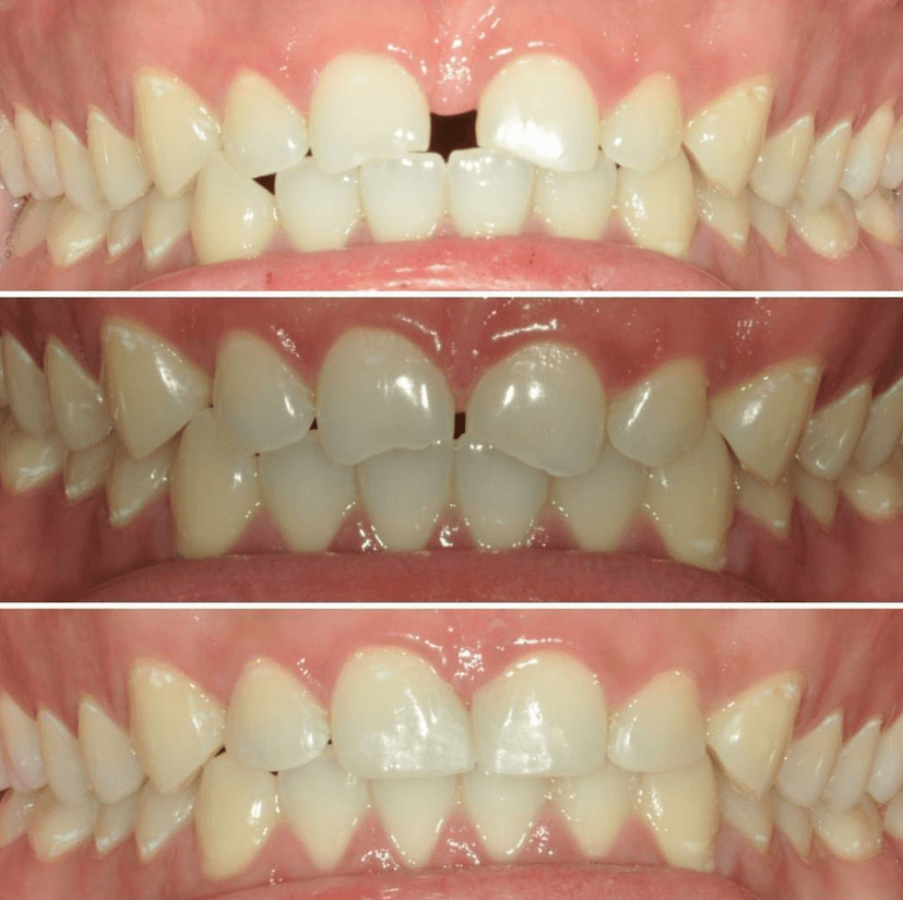 Before & After Photo