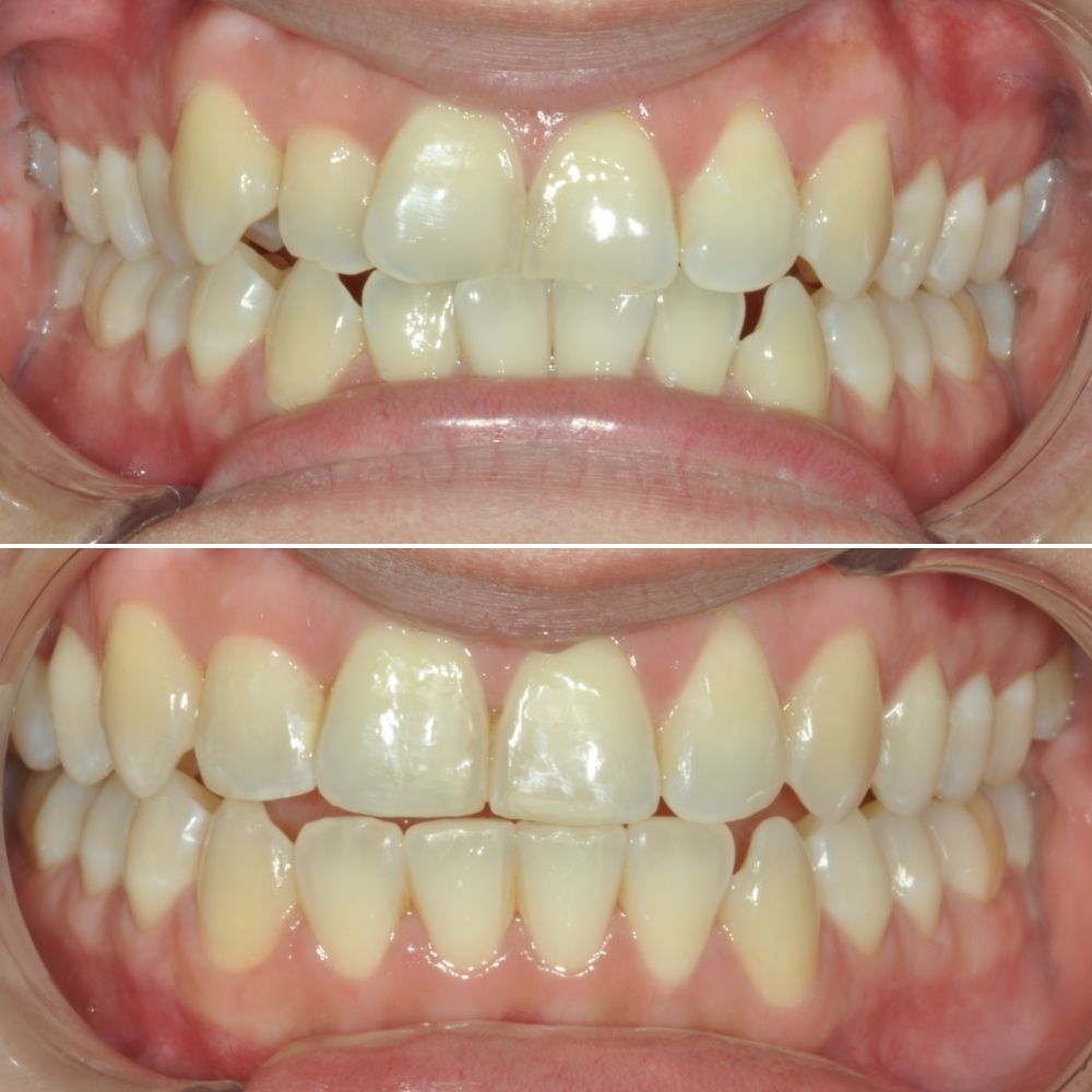 Before & After Photo