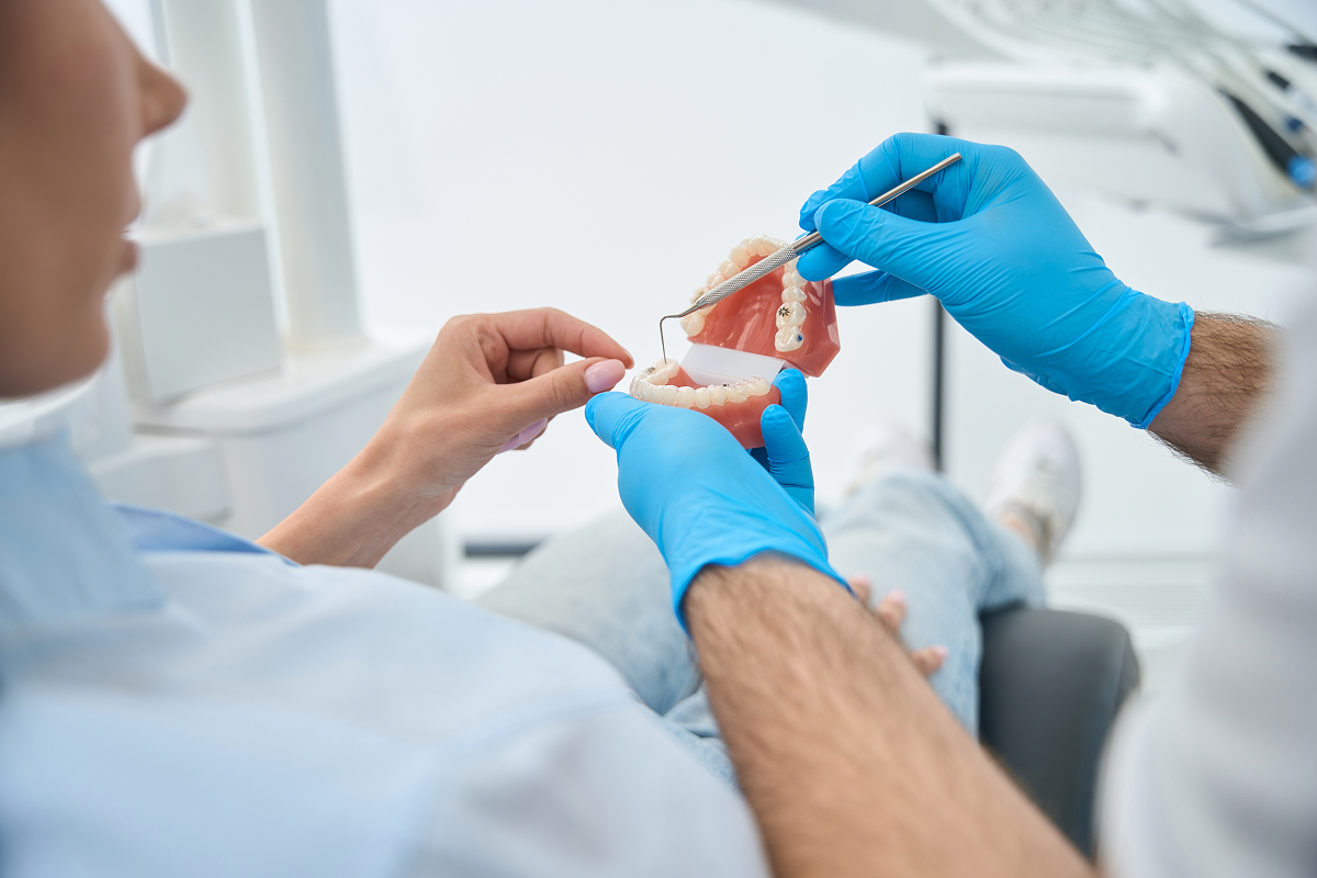 Dental Implants Versus Bridges