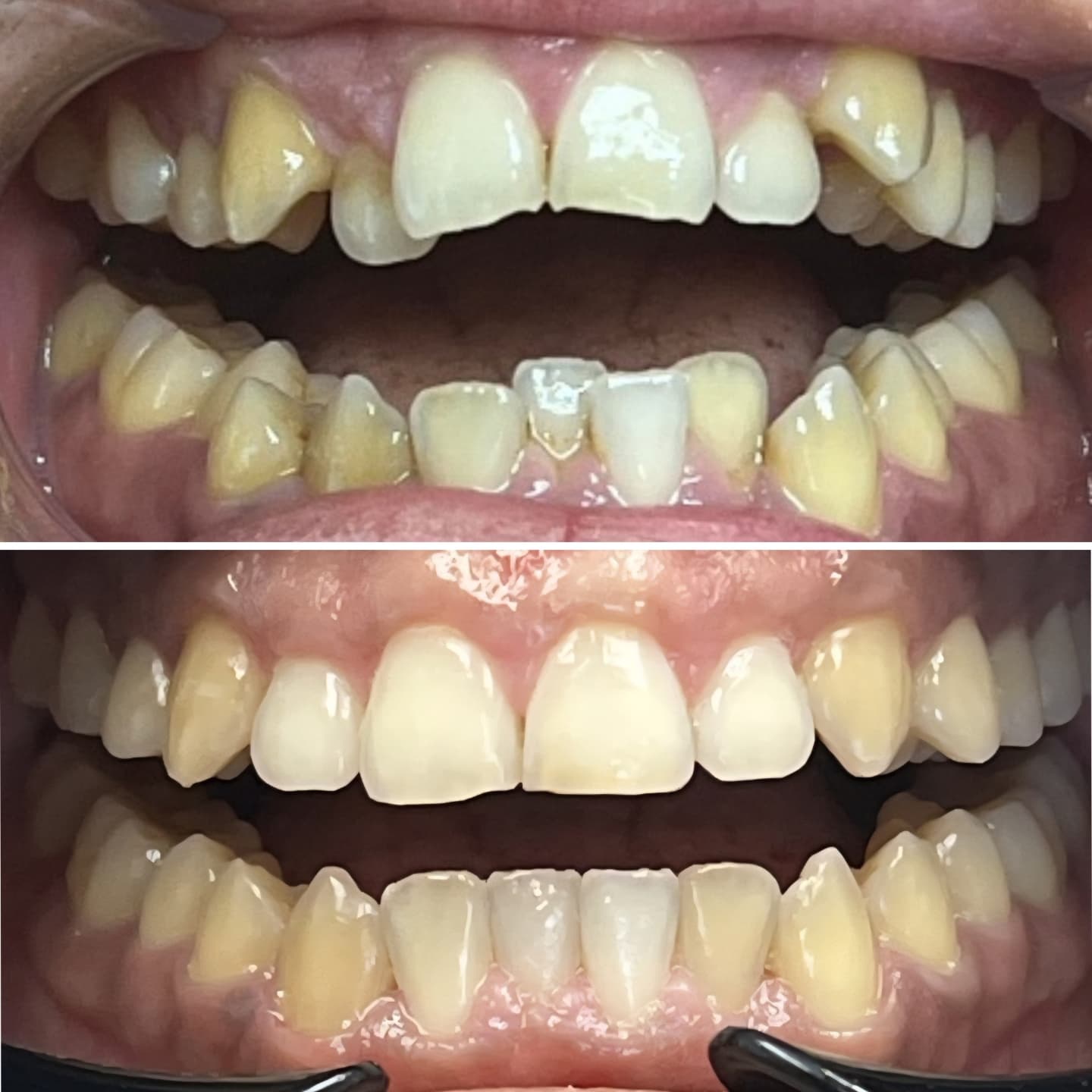 Before & After Photo
