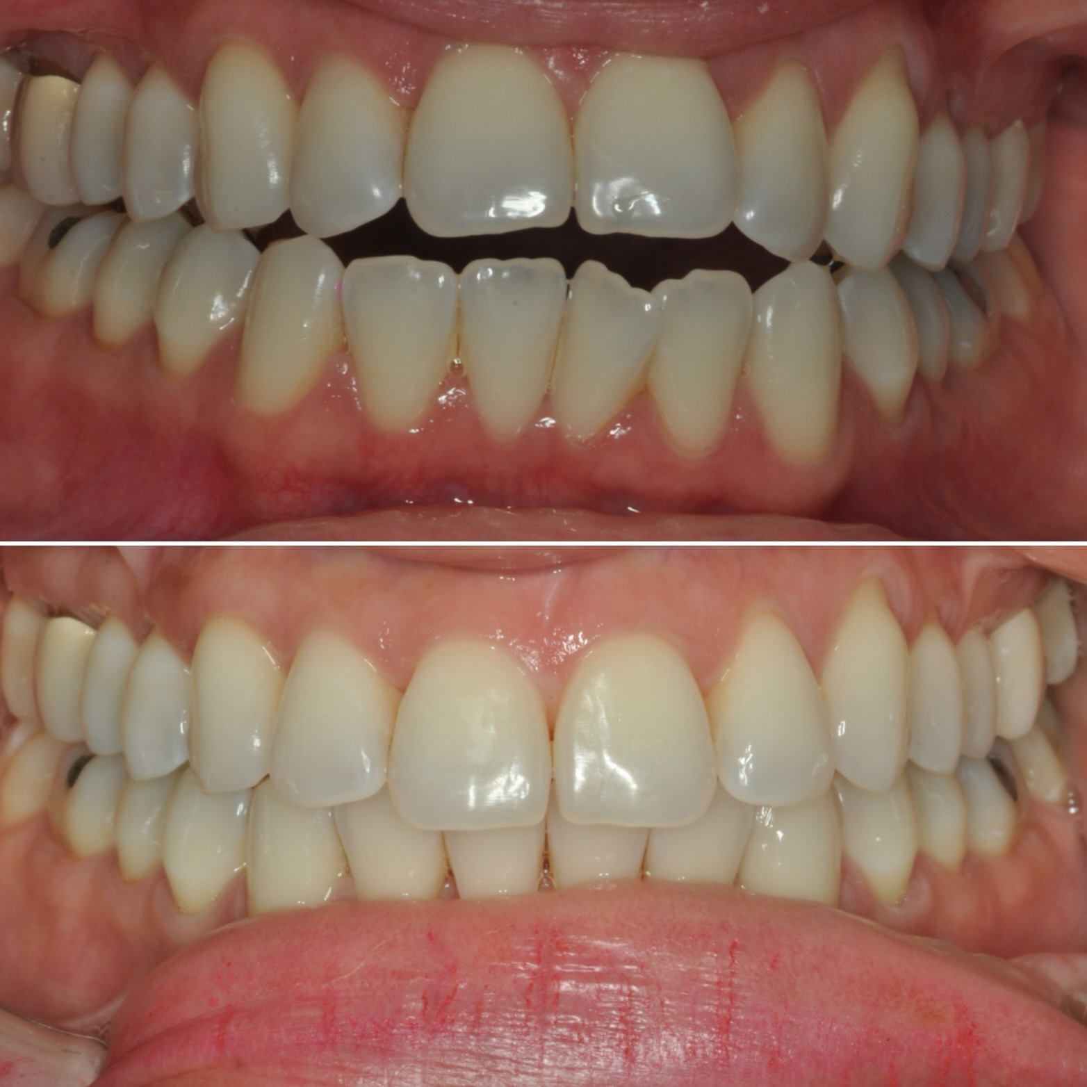 Before & After Photo