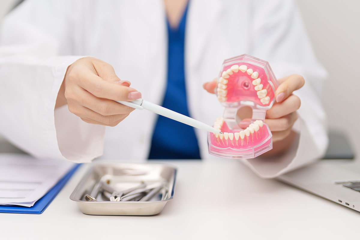 Dentist explaining what happens after tooth extraction using a dental model