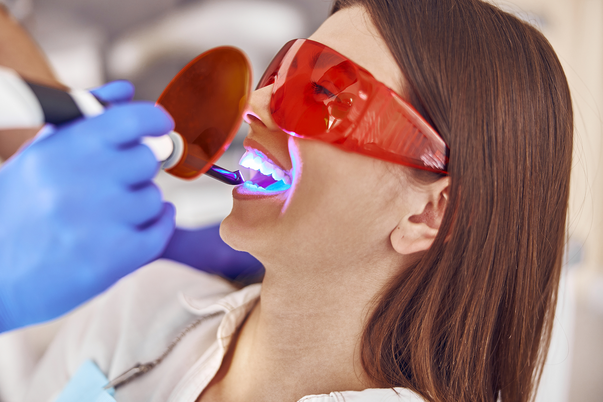 Dental filling material being hardened with a curing light